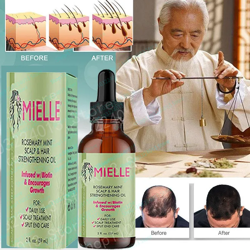 

Эфирное масло для роста волос с мятой, масло с розмарином для укрепления волос, питательное средство для разделения кончиков и сушки, органические волосы Mielle