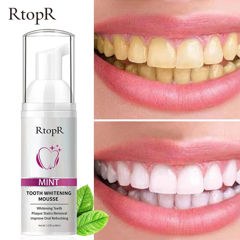 

RtopR Teeth Whitening Cleansing Mousse Tartar Removes Stains Teeth Oral Hygiene Mousse Toothpaste Whitening and Staining