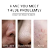 Amino Acid Oil Controlling Acne Facial Cleanser Gentle Cleansing Skin Moisturizing Plant Extract Double Tube Facial Cleanser 80g 4