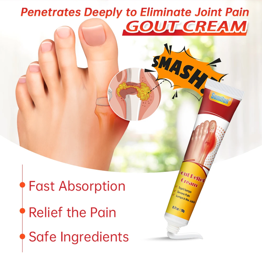 1/3/5/10/30Pc Sumifun Gout Relief Cream Bunion Hallux Valgus Toe Pain Ointment Finger Muscle Joint Swelling Ache Massage Plaster