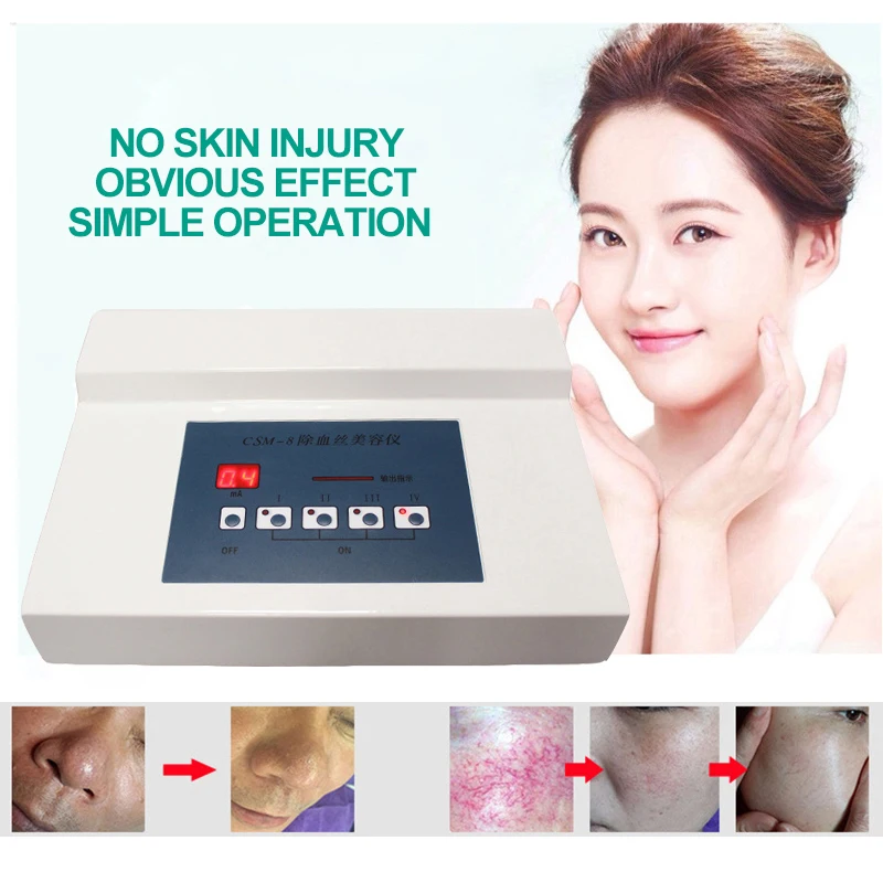 High Frequency Spider Veins Removal Device Remove Facial Thread Veins Red Blood Vessel Spots Vascular Removal Beauty Equipment