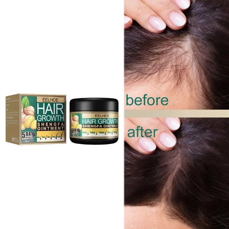 Description Picture 4 of itemSdatter EELHOE Ginger Oil Vitamin E Oil Hair Growth Cream Moisturizing Care Essence Hair Scalp Loss Massage Hair Conditioners