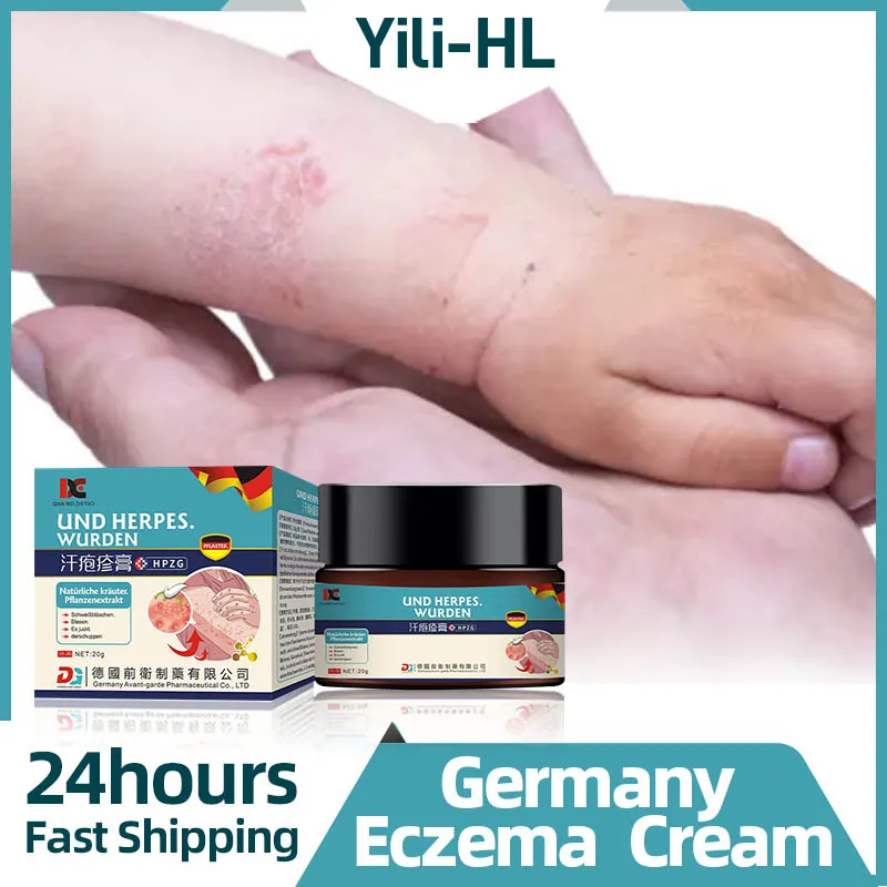 

Eczema Treatment Cream Pompholyx Psoriasis Dermatitis Eczematoid Fungus Antibacterial Anti-itch Herbal Ointment Germany Medicine