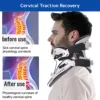 Adjustable Cervical Collar, Neck Brace Support Orthosis, Fixable Neck Posture Corrector, Pain Relief, Traction Spine Alignment 2