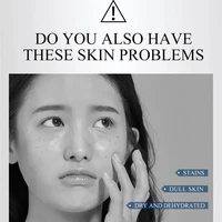 Youbuy Whitening Cream Skin Care Remove Freckle Melasma Dark Spots Corrector cream - Image 2