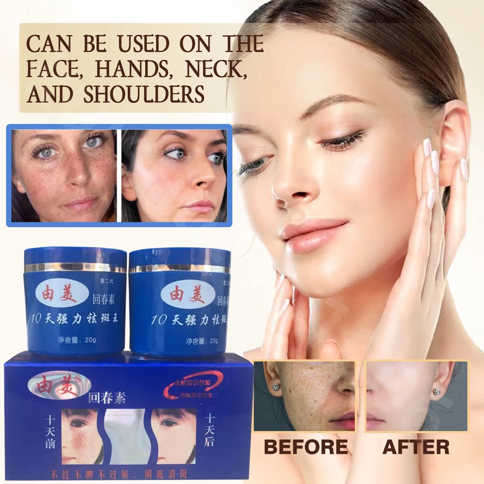 10 DAYS Freckles Removal Day & Night Cream Remove Dark Spots Pigment Whitening and Brightening Skin Care