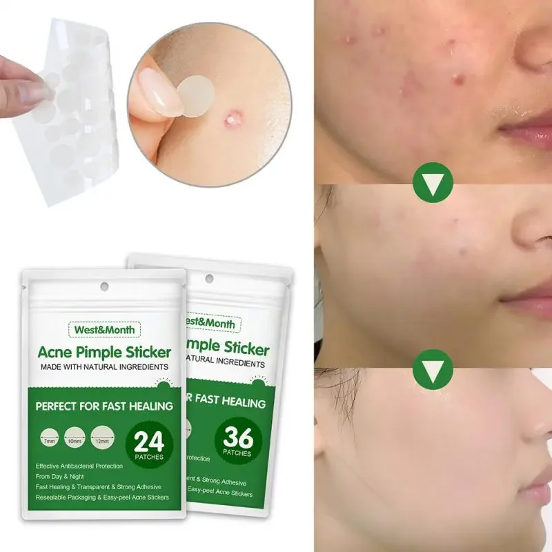 24/36pcs Acne Pimple Patch Stickers Invisible Waterproof Absorb Pus Acne Pimple Remover Hydrocolloid Acne Cleaner Skin Care Tool