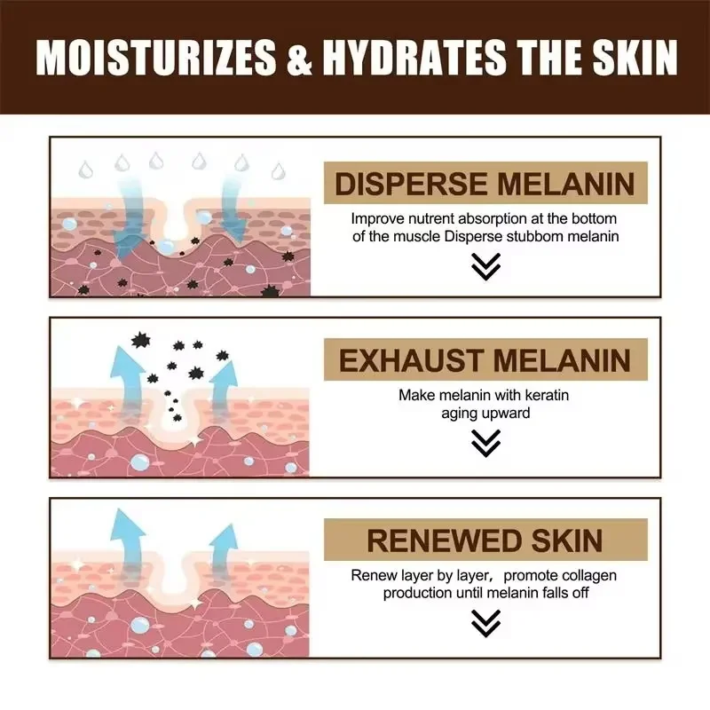 Facial Cream Whitening Freckles Removal Melasma Dark Spots Corrector Lighten Melanin Pigmentation Brighten Anti-Aging