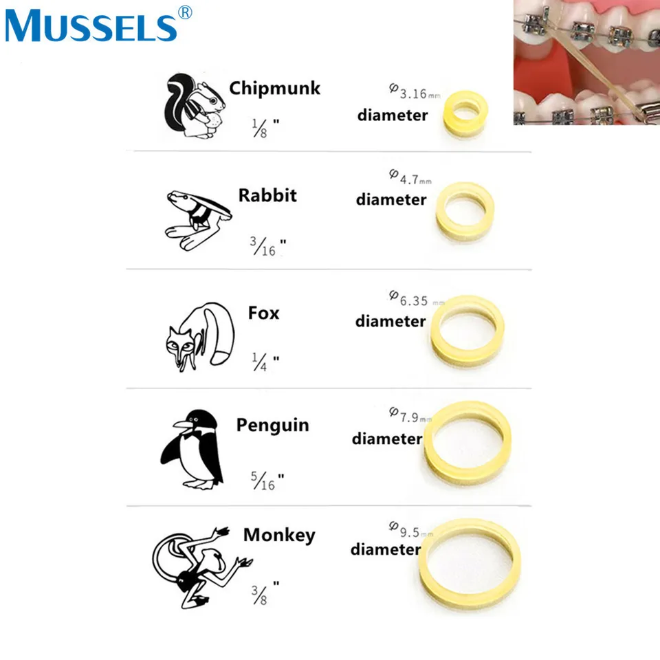 Elastici Modificate Per Laboratorio Dentale 1000 Elastici Ortodontici In Lattice Naturale - Per Apparecchi Dentali, Usati In Odontoiatria E Laboratori Anelli Dentali Lattice - Foto 2
