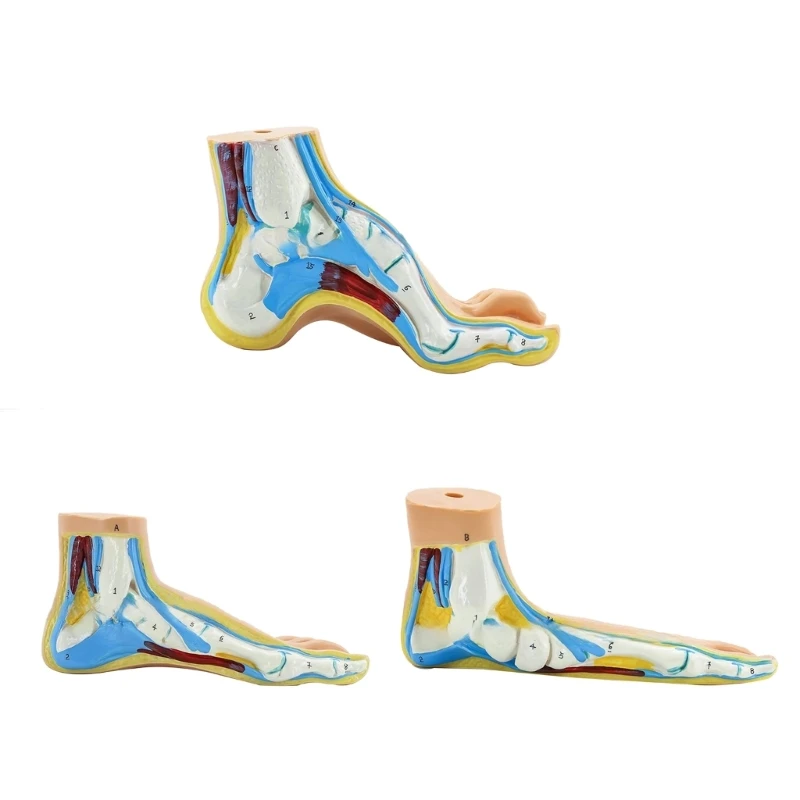 

Human Foot Anatomy Model with Digital Signs, Normal/Flat/High Arched Foot Anatomy Model for Medical Teaching