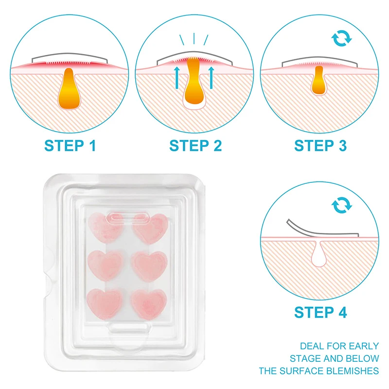Face Patches For Pimples Microneedles Drying Patch Blemish Covering Stickers 6 Count Invisible Spot Care Absorbing All Day