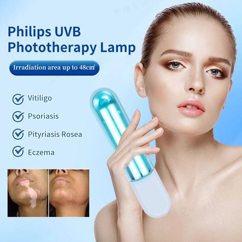 

311nm UVB Light Phototherapy for Vitiligo Psoriasis Eczema Skin Problems Treatment Ultraviolet Lamp