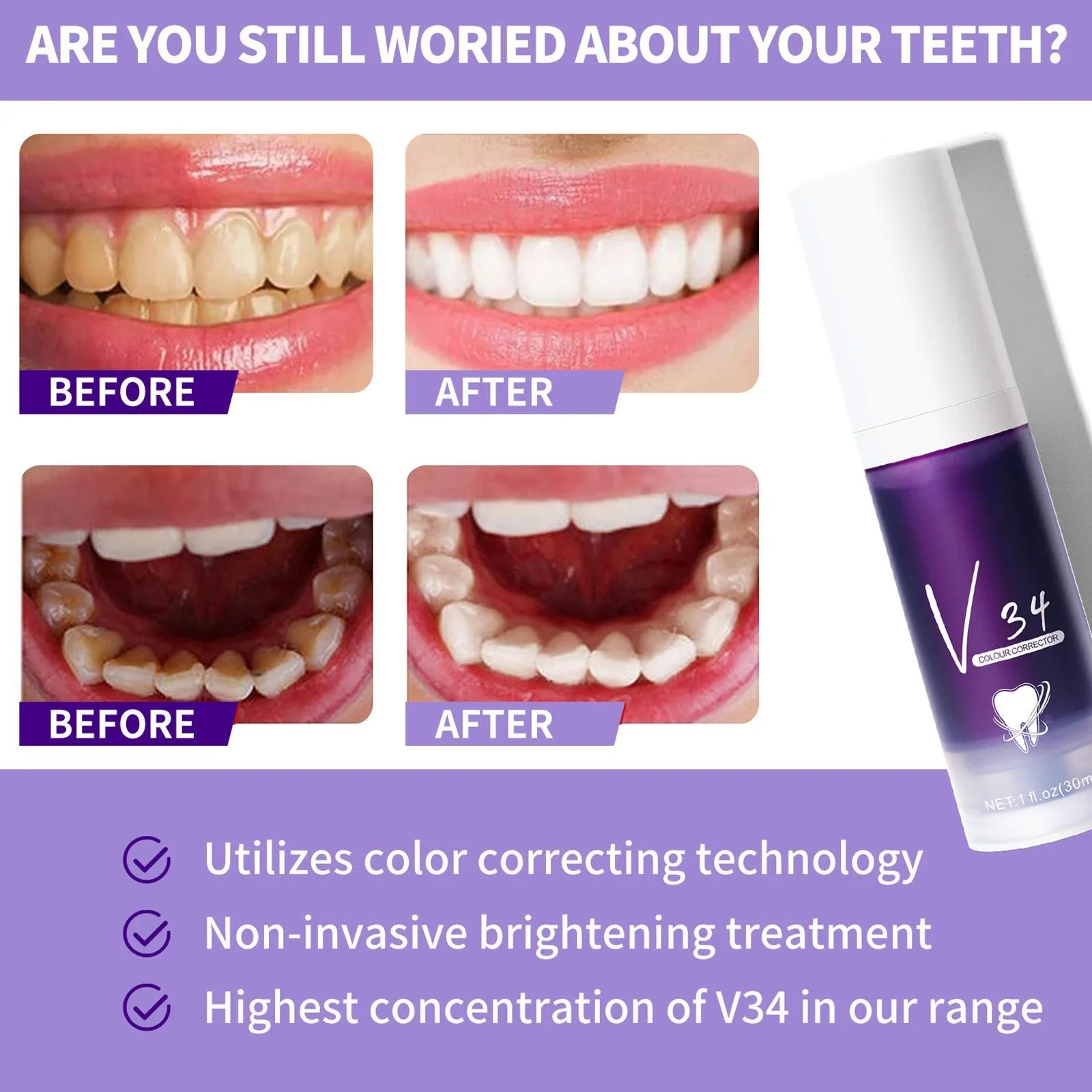 Рисунок 3 - Верхняя зубная паста для отбеливания зубов