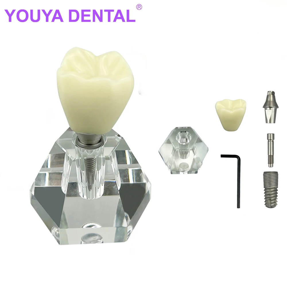 

Dental Crystal Implant Tooth Model Teeth Adult Models Detachable Demonstration Dentistry Lab Study Teaching Material Dental Impl