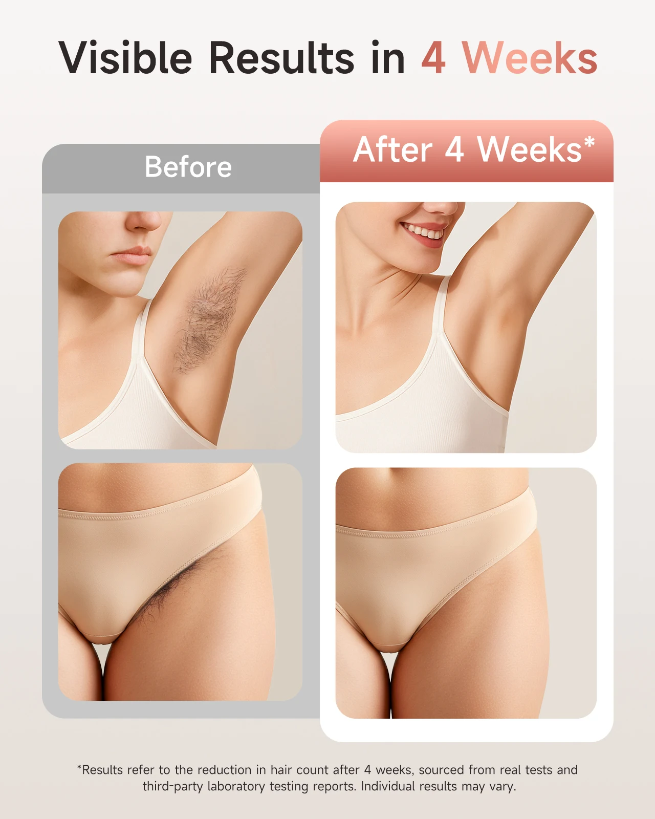 Laser Hair removal IPL 999900+ Flashes Epilator 9 Levels Permanent IPL Painless Photoepilator 3 in 1 face and body Women Men laser hair removal kit