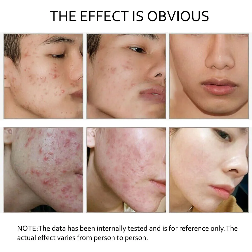 Sérum au rétinol anti-rides et éclaircissant pour le visage_voghion.com