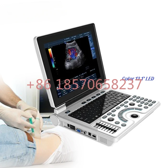 

Cheap Ecograph Laptop notebook Portable Black and White medical original ultrasound