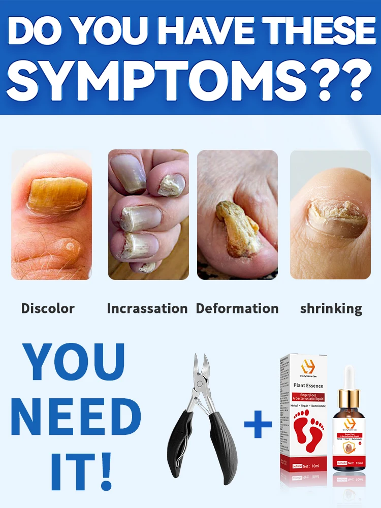 Ingrown nail nippers, toenail clippers, deep nail groove manicure tools, help essential oil absorption, solve problems