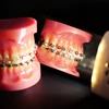 Orthodontic Anti-fog Reflective Glass With Fan Dental Oral Reflector Mirror For Defogging Occlusal Cheek And Tongue Irradiation 3