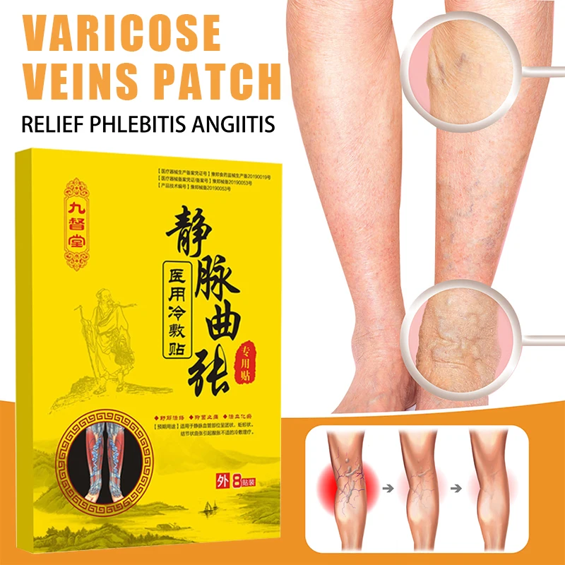 Varicose Veins Patch Phlebitis Vasculitis Treatment Sticker Thigh Spider Pain Relief Plaster Remove Vascular Blockage 8 Pcs/Box