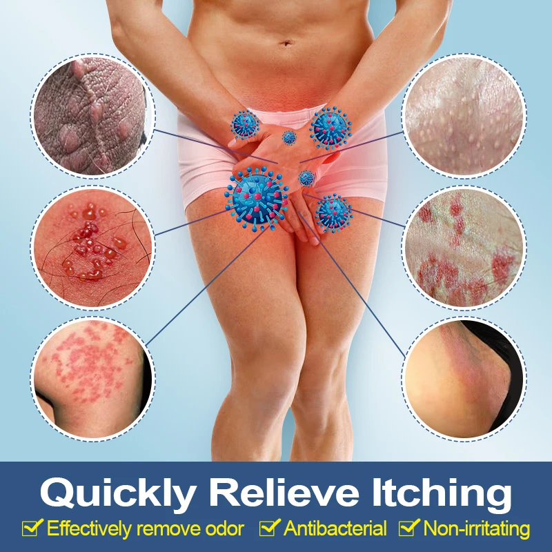 1pcs Men's Antibacterial Cream Anti-itch Anti-fungal Penis Pruritus Private Odor Psoriasis Cream Rash Jock Itch Eczema G015 antibacterial anti fungal cream