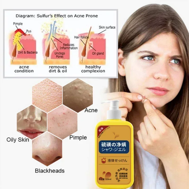 Body Wash 320ml Sulfur Liquid Mite Removal Soap Shower Gel Deep Cleansing Body Cleansers Whole Body Acne Wash