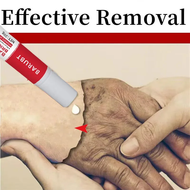 Effective Whitening Cream Freckles Dark Spots Removal Face Brighten Products Fade Melasma Corrector Lighten Melanin Beauty