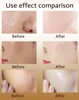 Pore Shrinking Essence Contraction Minimizer Pores Oil Control Eliminate Dilated Pore Remover Face Skin Care Serum 6