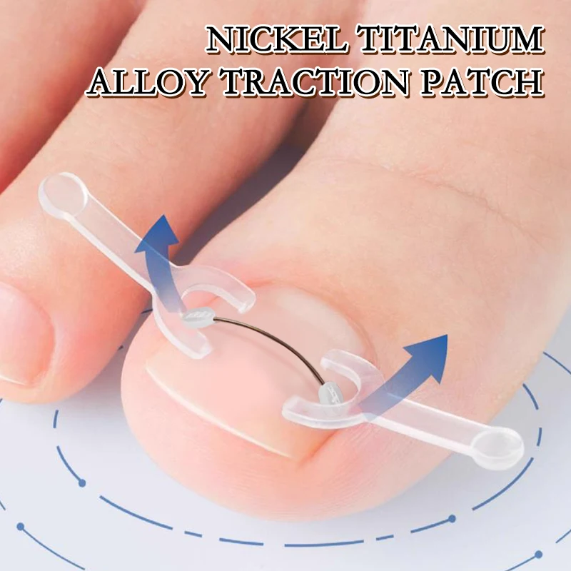 1PC Ingrown Toenail Correction Tool Ingrown Toe Nail Treatment Elastic Patch Sticker Straightening Clip Brace Pedicure Tool toe corrector manicure pedicure tools
