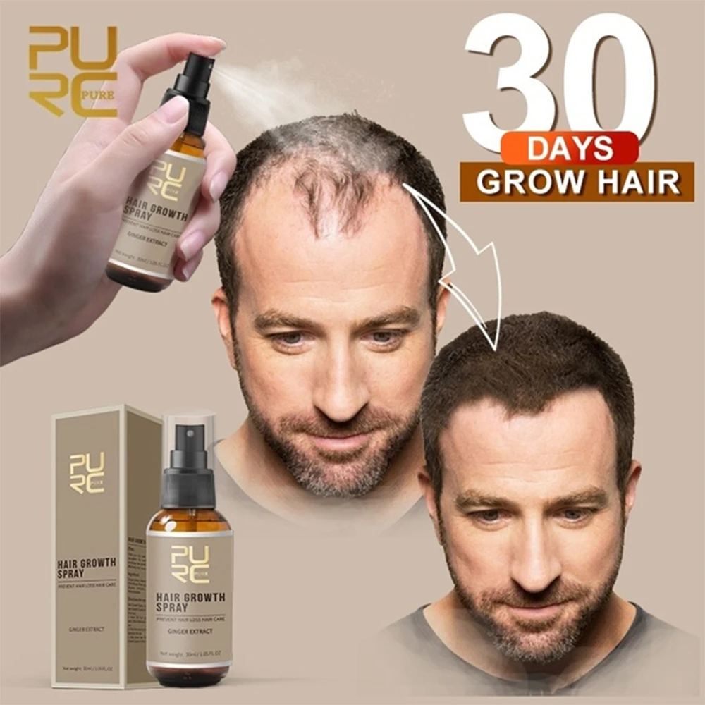 Ginger Hair Growth Spray Fast Growing Spray Scalp Nutrient Solution Prevent Hair Loss Hair Care Oil For Men Women Hair Care