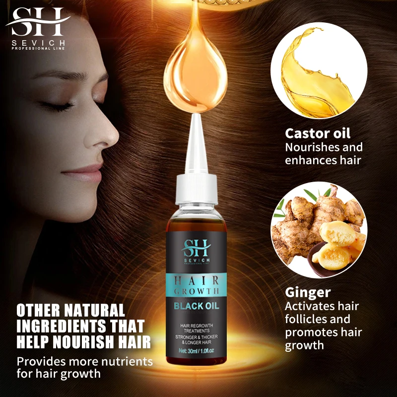 Sevich Natural Ginger Germ Essential Oil Effectively and Rapidly Grows Softens Hair Care Prevent Hair Loss Essential Oil 30ML
