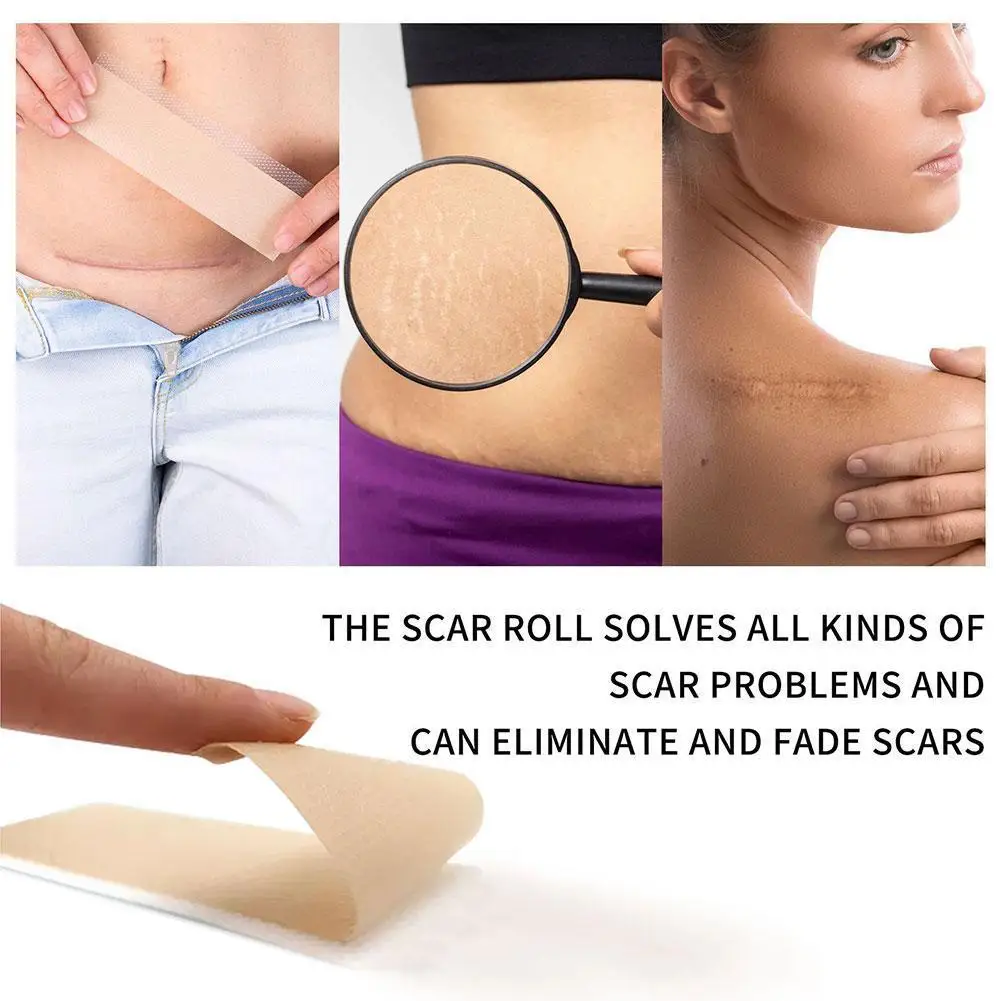Acne Surgical Stretch Marks Removal Scar Cream Pimples Skin Acne Self-adhesive Tape Repair Tone Gel Spot Patch Face Burn E8L7