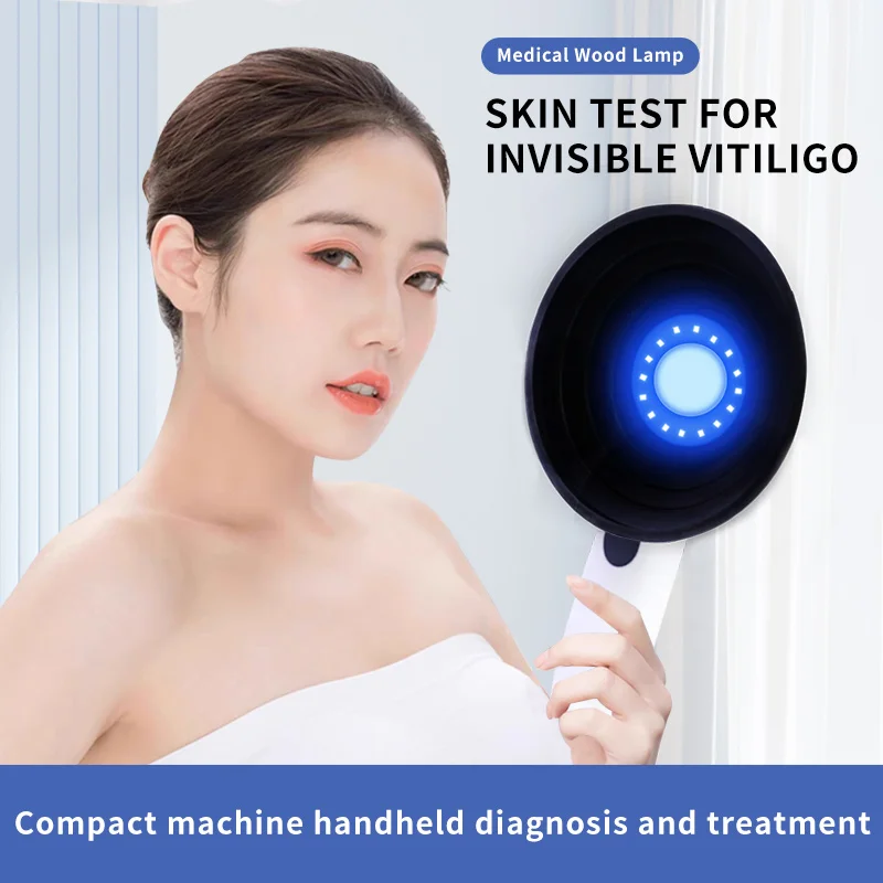 Cat Ringworm Detection Woods Lamp Skin Examination Skin Fungus Detector Vitiligo Pityriasis Versicolor Melasma Woods Light - Image 5