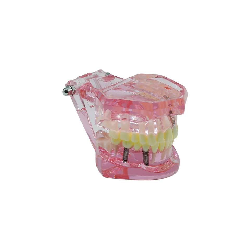 Dental Teaching Model - Single Piece Implant & Bridge Demonstration Tooth With Brackets 6 thumbnail image