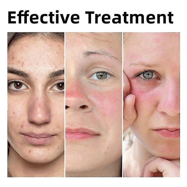 30 Ml -Es Cerave Felújítás Retinol Szérum Bőr Megújítása A Hidratálásának Javítása Hidratáló Hialuronsav - Image 3