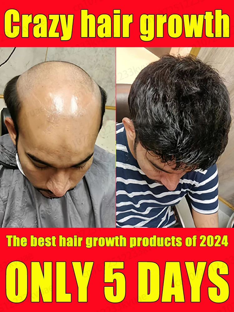 Hair Growth Serum Hair growth product solves hair loss and baldness problem makes hair grow longer
