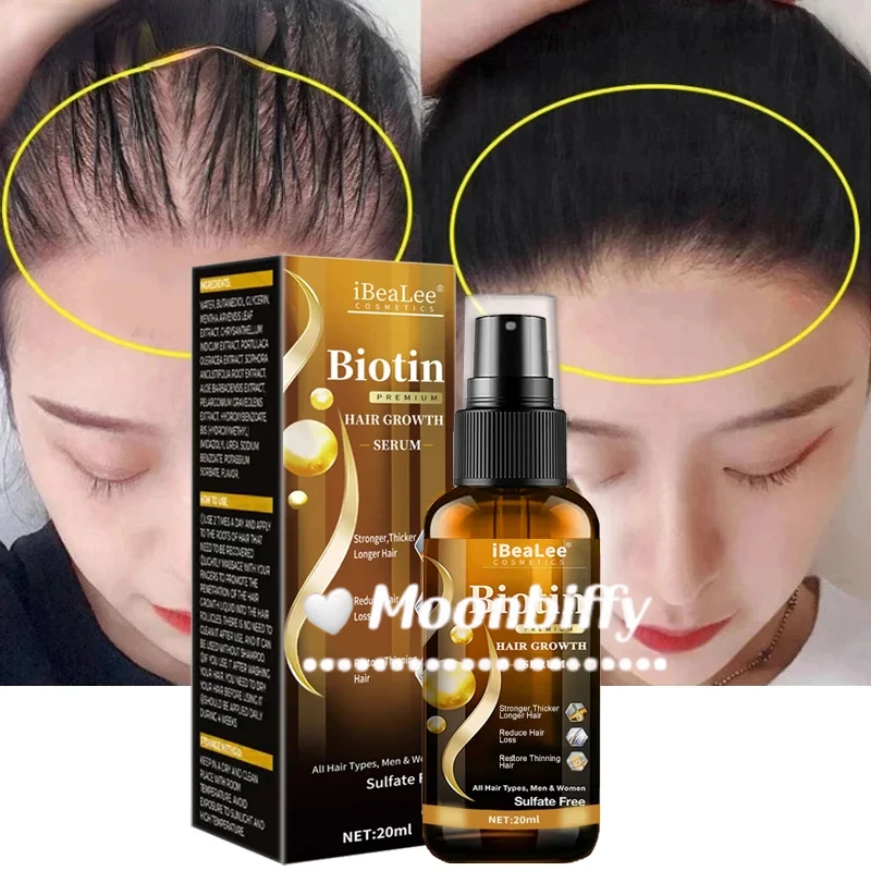 Fast Hair Growth Spray Products Anti Hair Loss Serum Prevent Baldness Treatment Scalp Dry Damaged Beard Hair Care Essential Oils