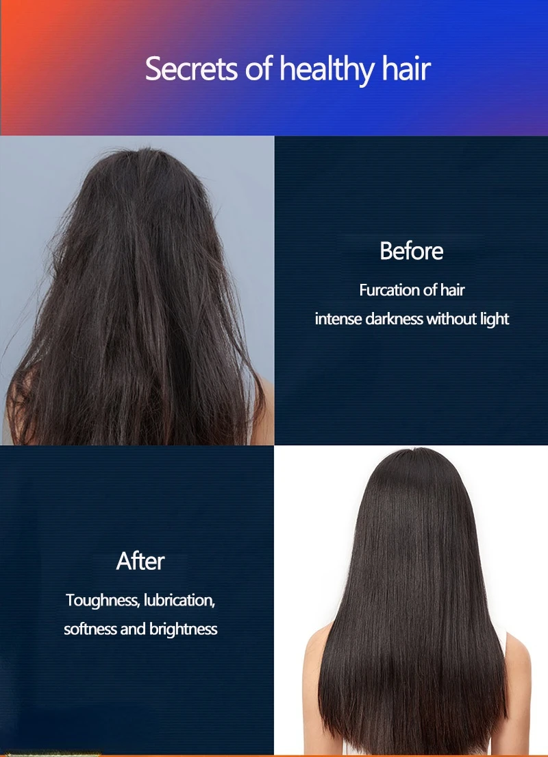 Secador de Cabelo Cuidados com os Cabelos Xiaomi Youpin Showsee Negativo 1800w Secagem Rápida Portátil Difusor Ionic Dobrável a4 Íon 8 íon negativo cuidados com os cabelos 1800w