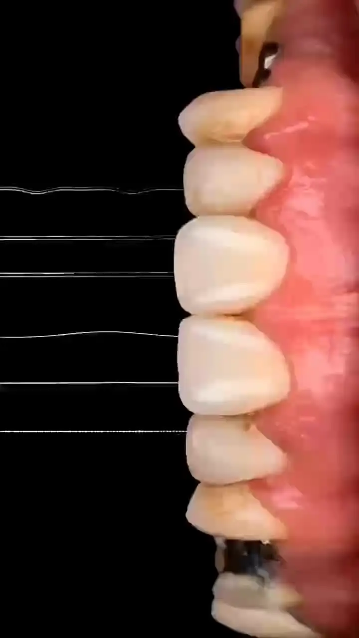 The CAD/CAMジルコニアセラミックス CAD/CAMフライス盤 - CEREC series - Dentsply Sirona - 歯科