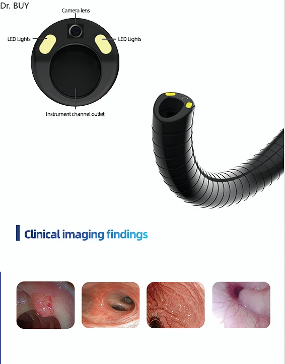 Reusable bronchoscope 12.1 screen