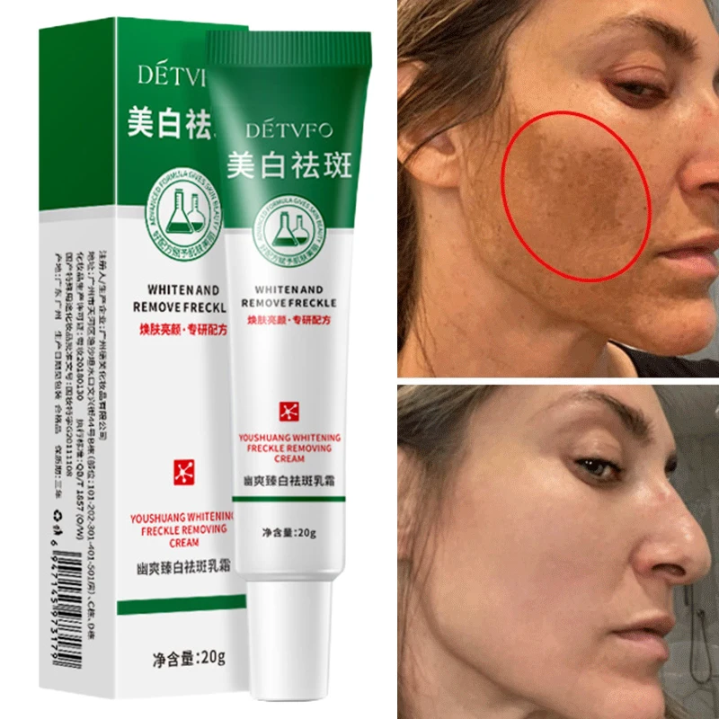 

Whitening Freckle Cream Effective Remove Melasma Cream Remove Dark Spots Melanin Moisturize Brighten Smooth Face Skin Care