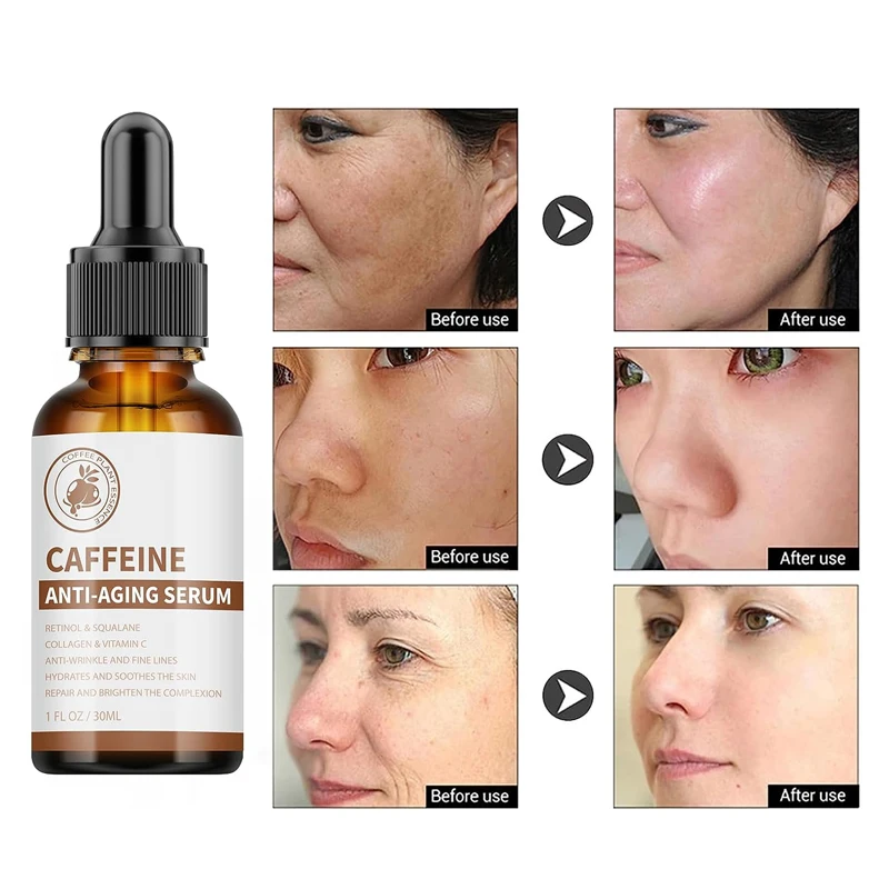 30ml Caffeine Face Serum Skin Care Anti Aging Pure Retinol Face Brightening Collagen Caffeine Anti Aging Serum