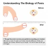 Quickly Thickening And Growth Enhancement Products, Extend Time of 65 Min +, Permanent, Big Size Of 30 cm/12 in, No Rebound, 6