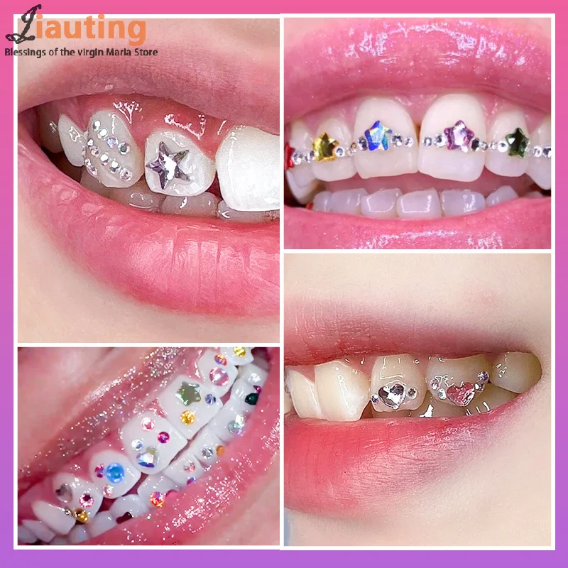 치과 보석 크리스탈 다이아몬드 장식 DIY 도구, 다양한 모양, 컬러 치아 쥬얼리, 아크릴 의치, 1 세트