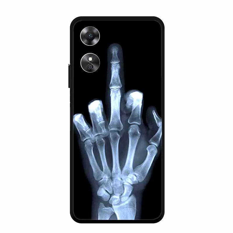 Cool Animal Design Black Edge Silicone Soft Phone Cover Case
