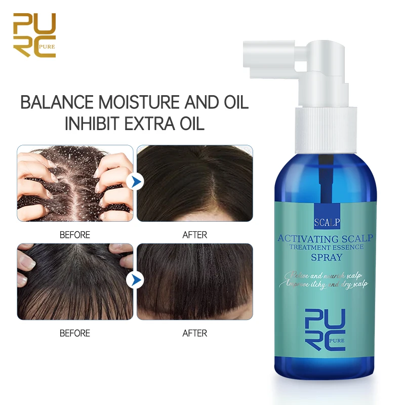 Hair & Scalp Treatment Anti-Dandruff Oil Control Itching Hair Care Products for Women Men hair treatment,scalp treatment