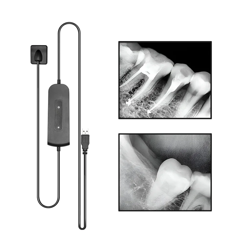 

Digital cameras Dental Dentistry Sensor X-Ray High-Frequency Rx Digital Intraoral Digital System H D Image Radiovisografo