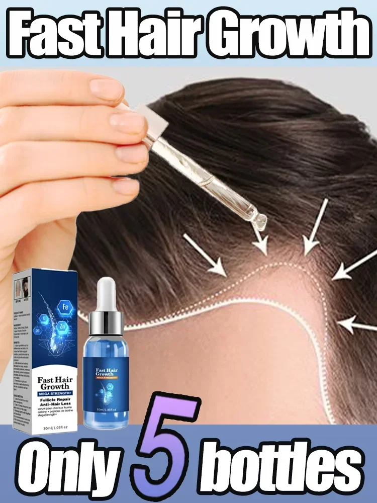 

Biotin Hair Growth Essential oil Products for Men Women Hair Loss TreatmentHereditary Baldness Fast Grow Regrowth Thicken Oil