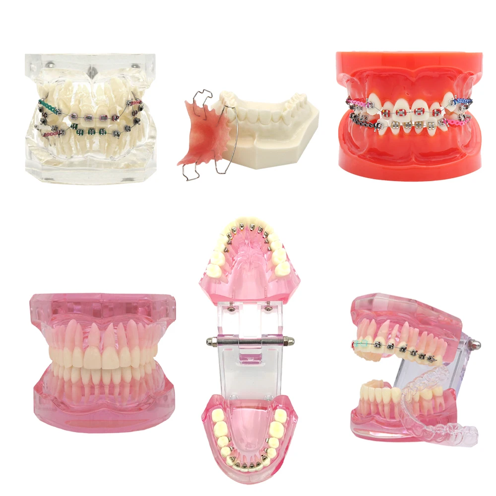

Orthodontic Model Teeth Dental Teaching Model Teaching Study Gum Tooth Models With Ortho Metal Bracket Arch Wire Ligature Ties