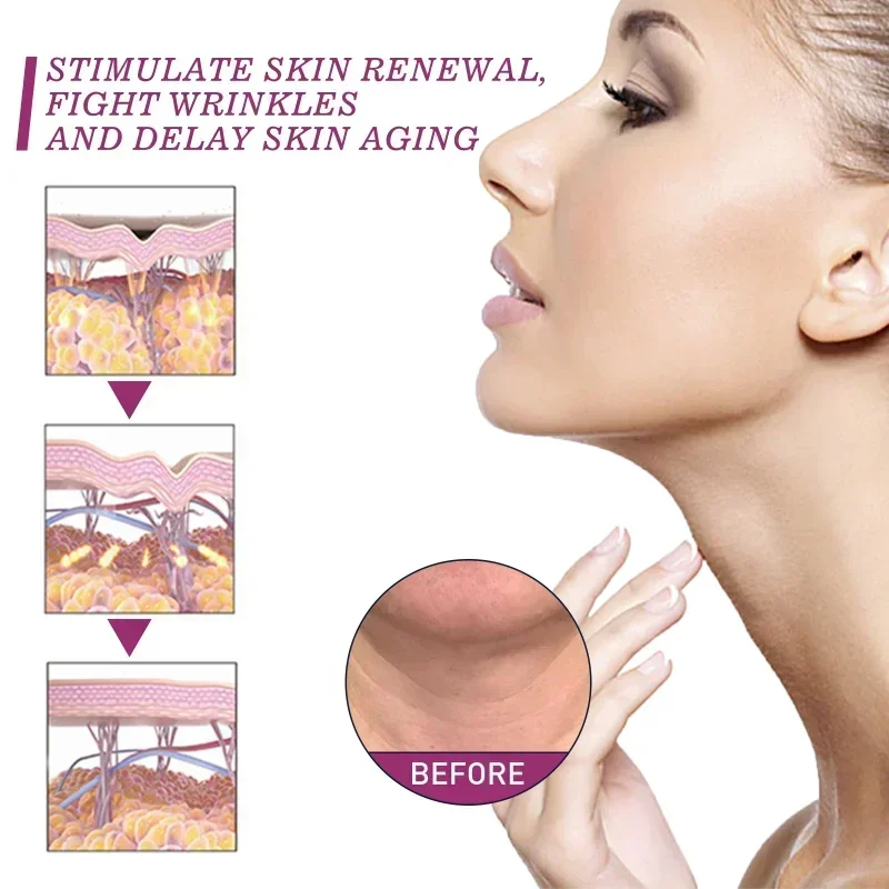 

Sdottor Collagen Neck Cream Firming Wrinkle Remover Cream Whitening Moisturizing Rejuvenation Skin Shape Beauty Neck Skin Care P